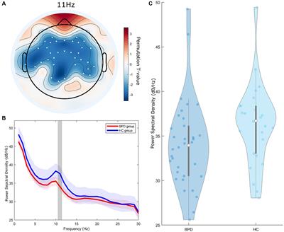 Neurophysiological insights into impaired mentalization in borderline personality disorder an electroencephalography study